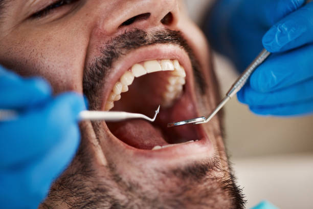 Best Emergency Denture Repair in Pflugerville, TX