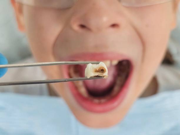 Best Same-Day Emergency Dental Services in Pflugerville, TX
